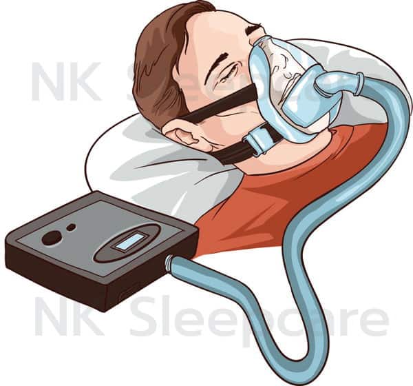 CPAP machine to treat snoring