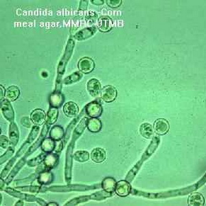 เชื้อรา Candida albicans