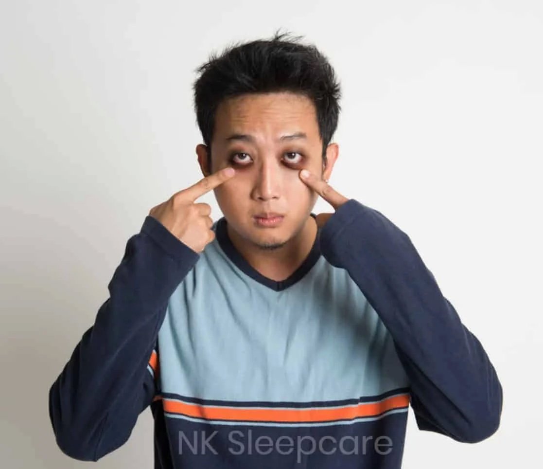 อาการนอนหลับไม่สนิท ขอบตาหมองคล้ำ