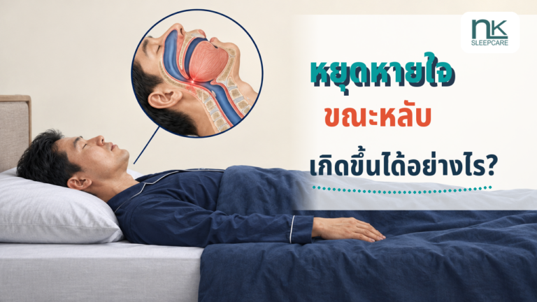 ผู้ชายนอนหงายพร้อมภาพขยายทางเดินหายใจที่ตีบแคบจากภาวะหยุดหายใจขณะหลับจากการอุดกั้น