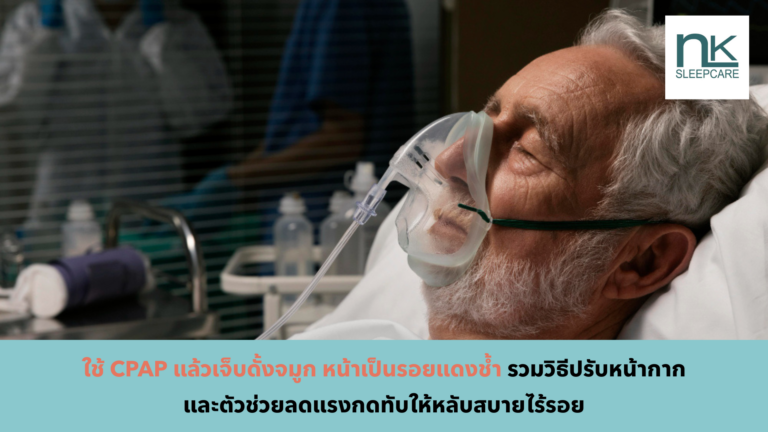 cpap หน้าเป็นรอยแดง