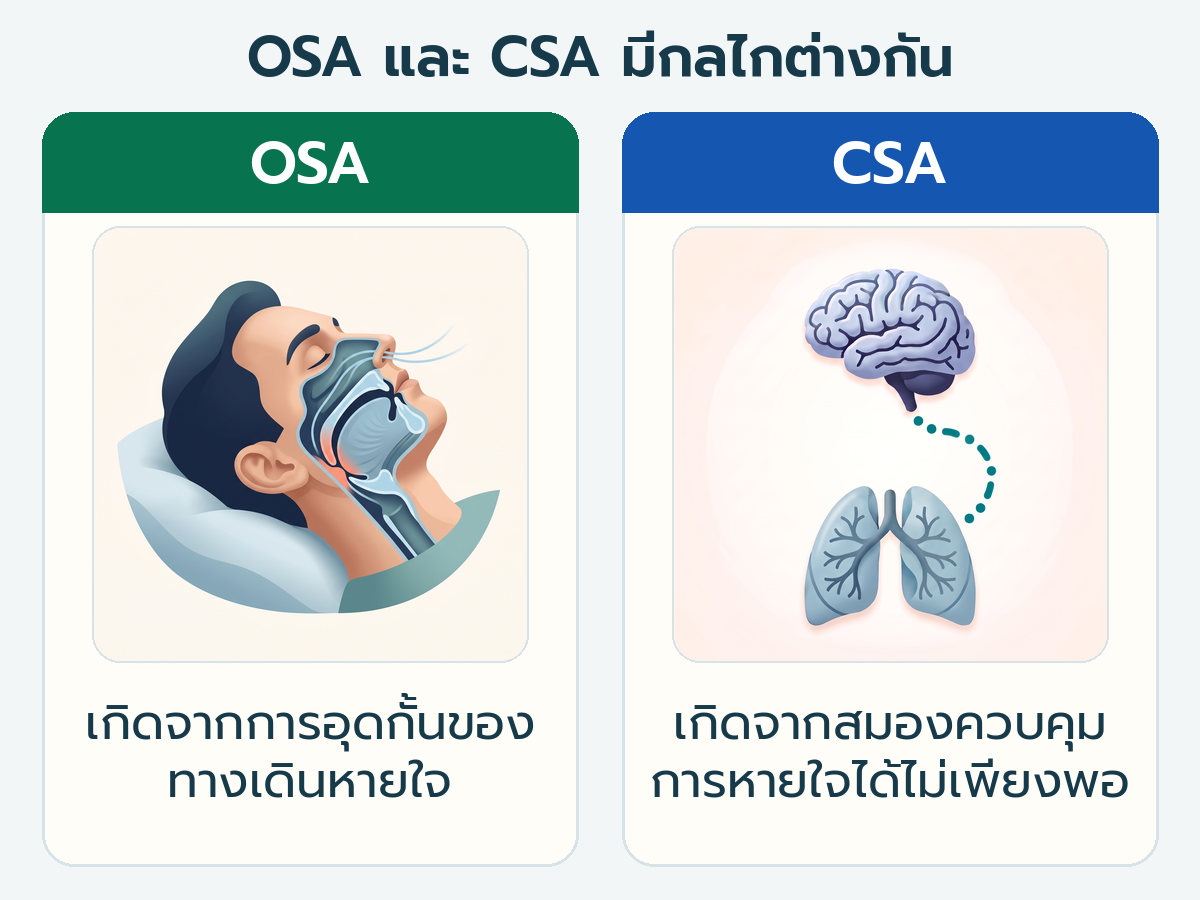 The diagram compares obstructive respiratory syndrome (OSA), where the airway is narrowed or closed, with chronic respiratory syndrome (CSA), where the brain sends insufficient signals to control breathing.